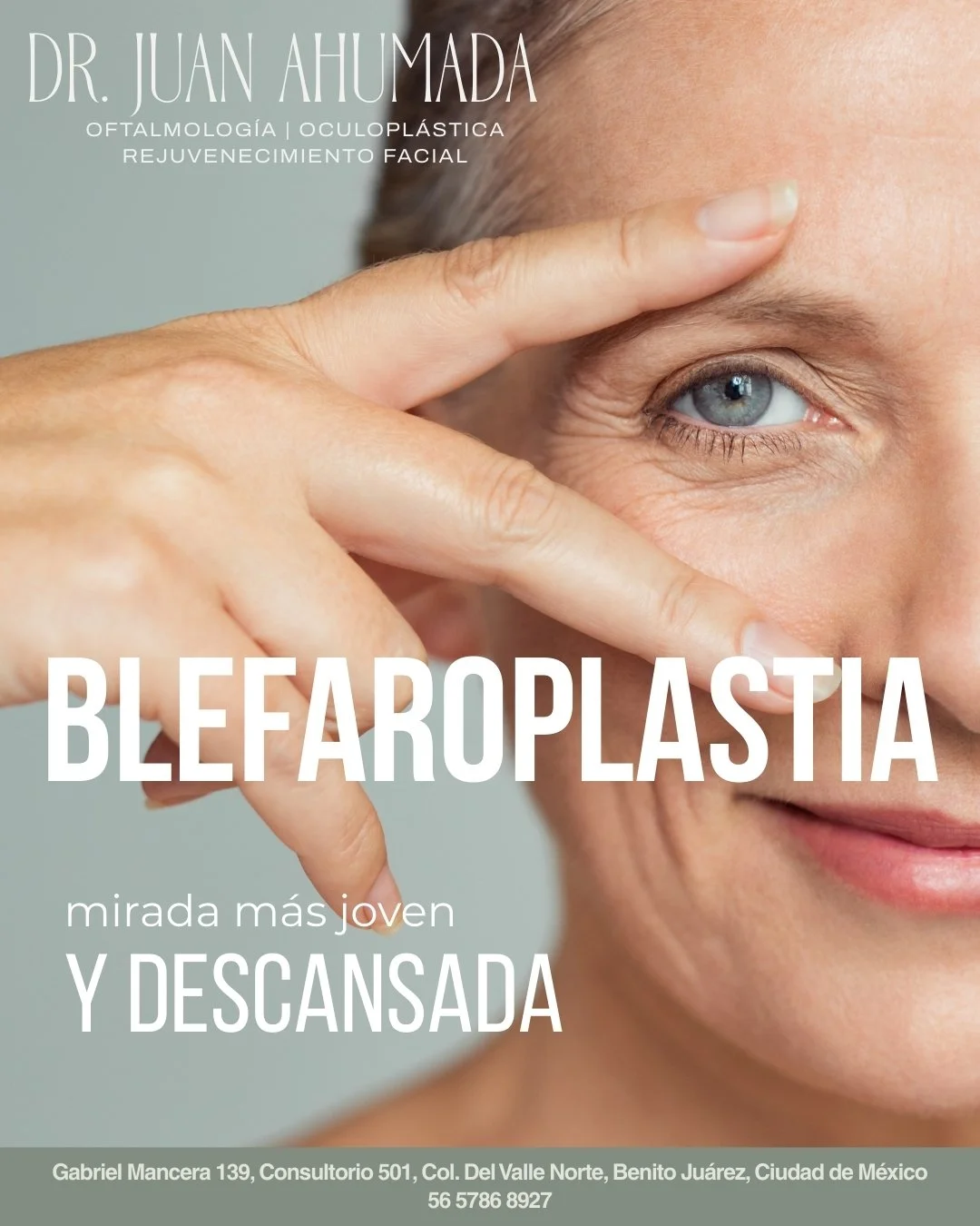 👀 &iquest;P&aacute;rpados ca&iacute;dos que te hacen ver cansado todo el tiempo?
✨ La blefaroplastia rejuvenece tu mirada de forma natural y duradera.
🔥 M&aacute;s luz, m&aacute;s frescura, m&aacute;s seguridad.

📩 Agenda tu valoraci&oacute;n y tr