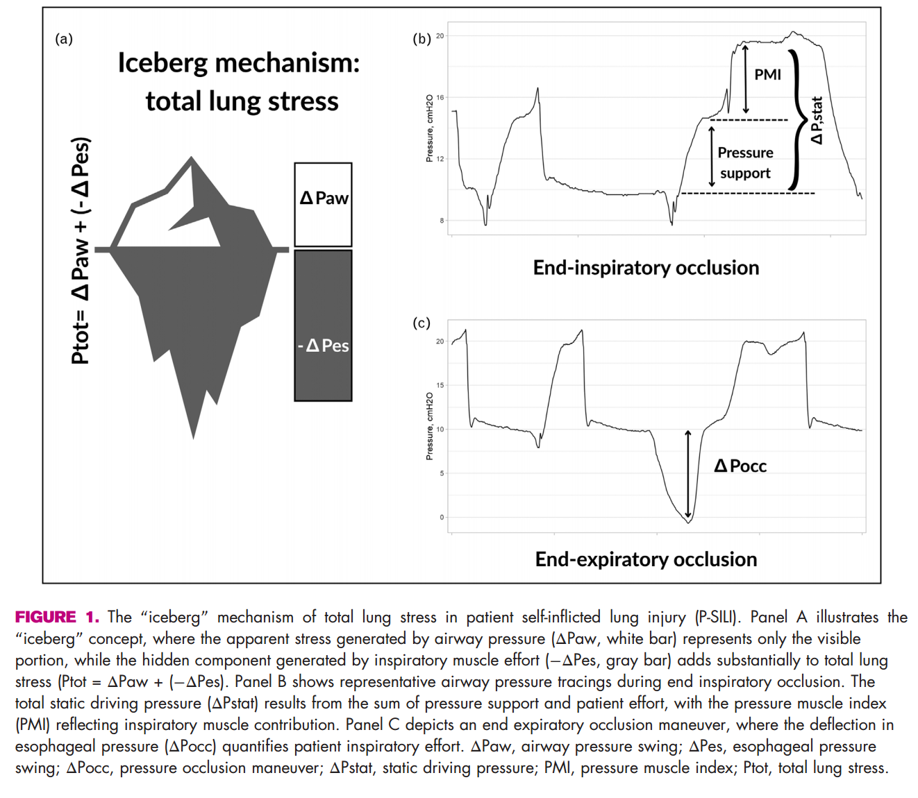 Patient self-inflicted lung injury an important phenomenon