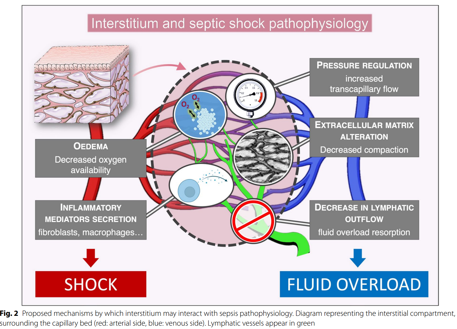 Role of the interstitium during septic shock: a key to the understanding of fluid dynamics?