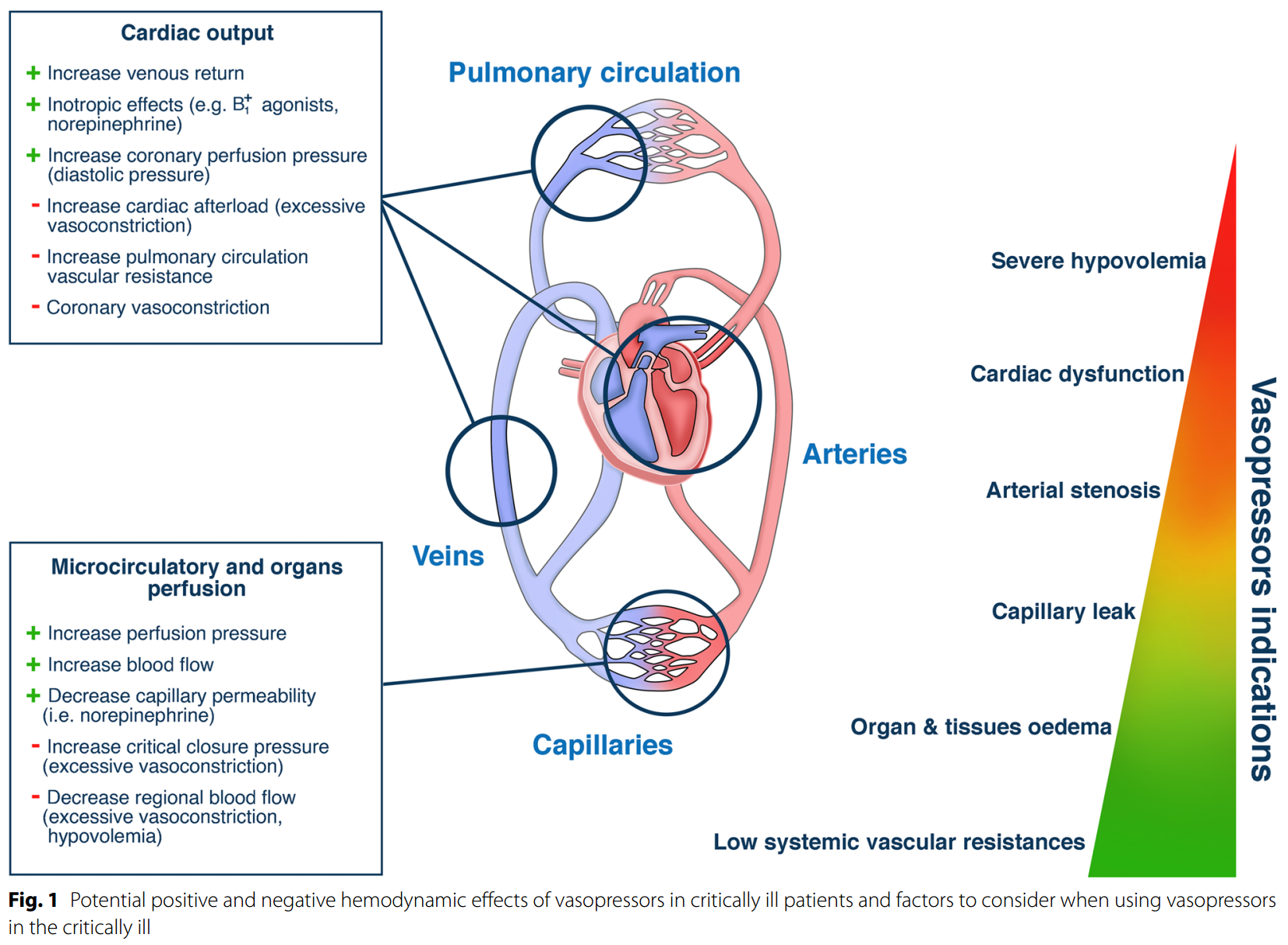 Ten tips to optimize vasopressors use in the critically ill patient with hypotension 
