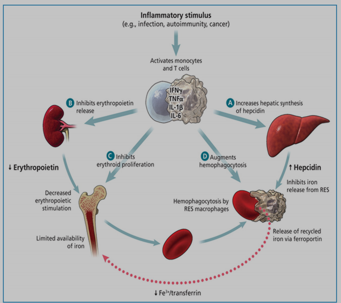 Anemia of Critical Illness : A Concise Definitive Review in Critical Care