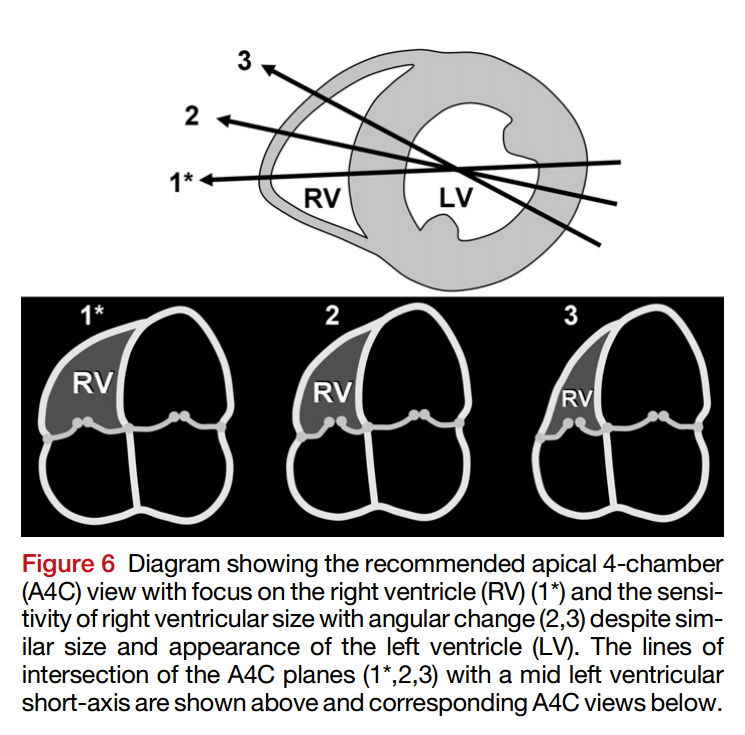 Guidelines for the Echocardiographic Assessment of the Right Heart in ...