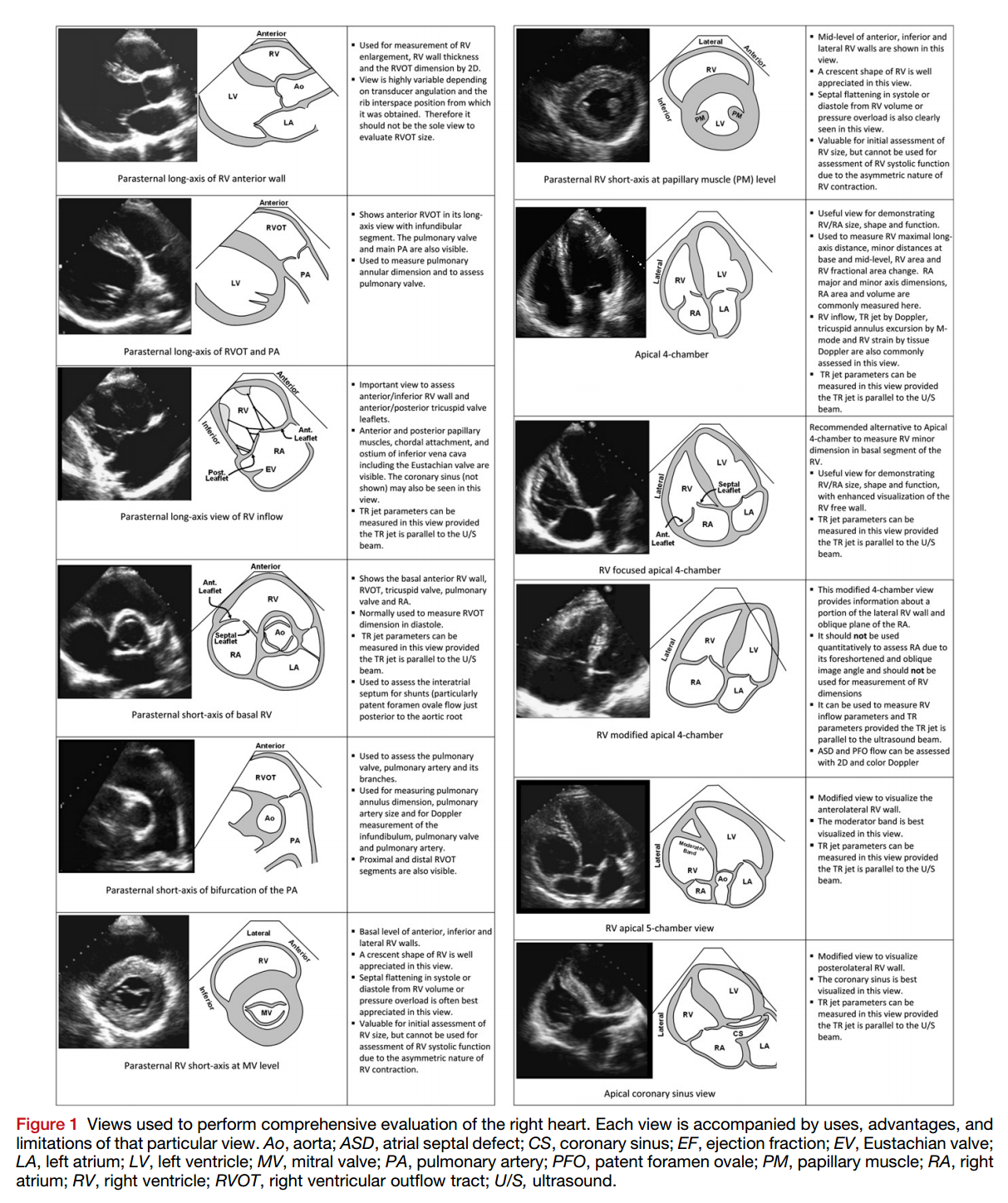 Guidelines for the Echocardiographic Assessment of the Right Heart in ...