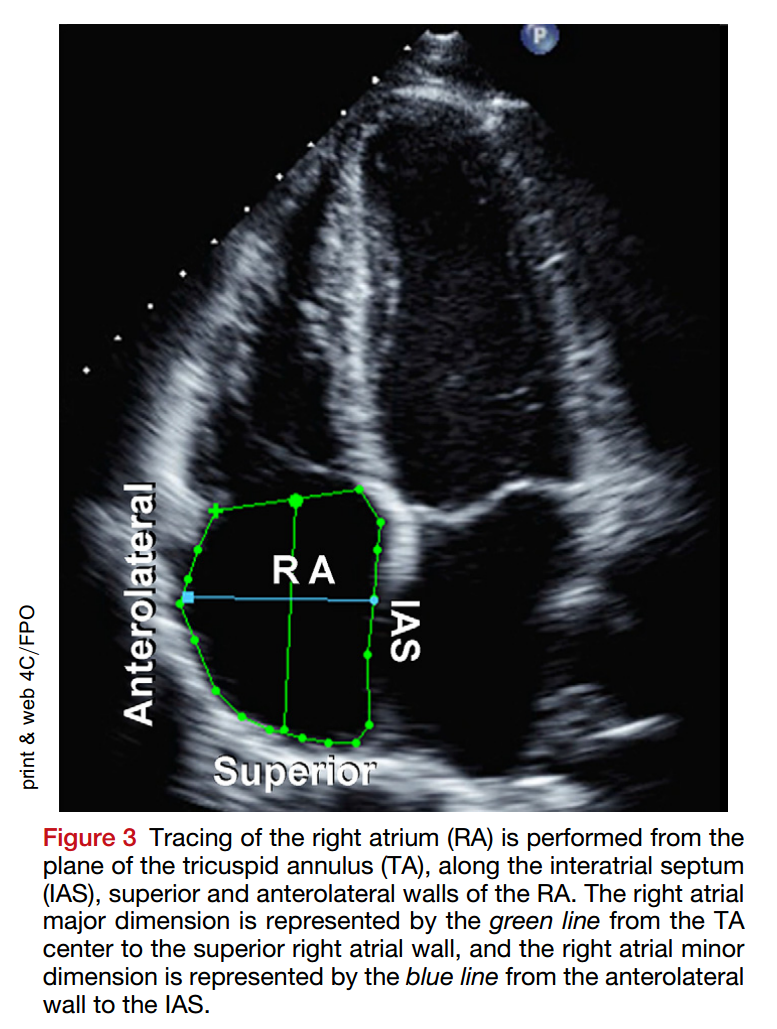 Guidelines for the Echocardiographic Assessment of the Right Heart in Adults : A Report from the American Society of Echocardiography