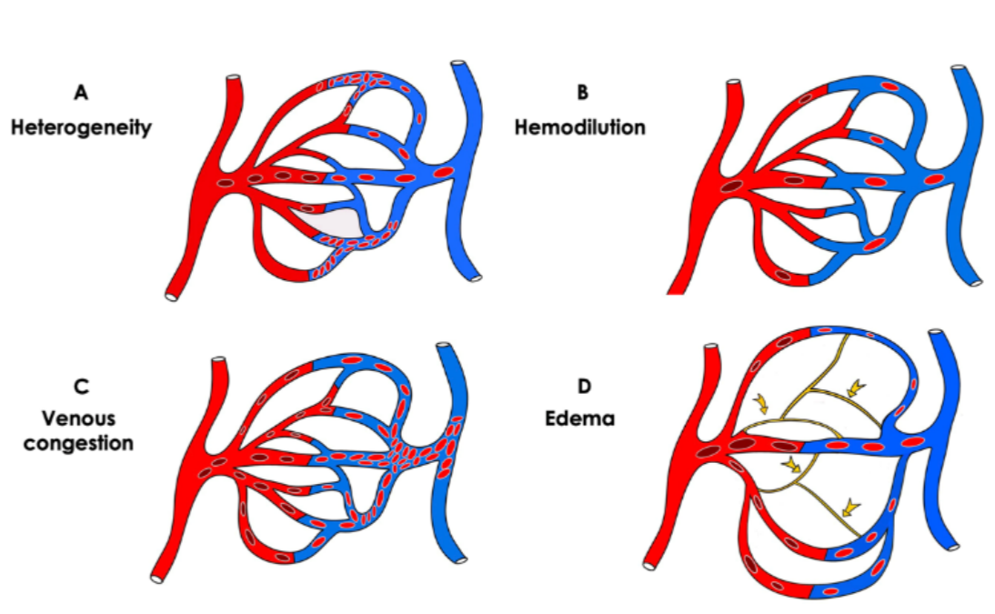 Beyond blood pressure : a comprehensive overview of clinical indices in shock and tissue hypoperfusion