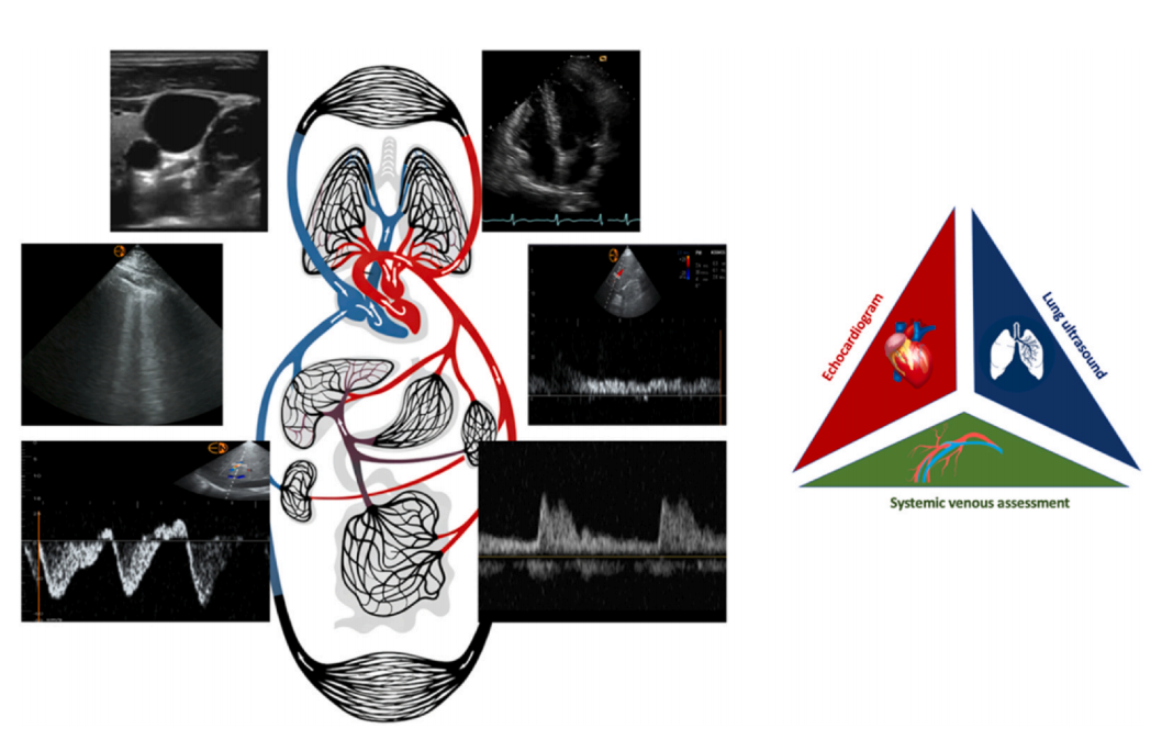Cardiopulmonary point-of-care ultrasound for critical care