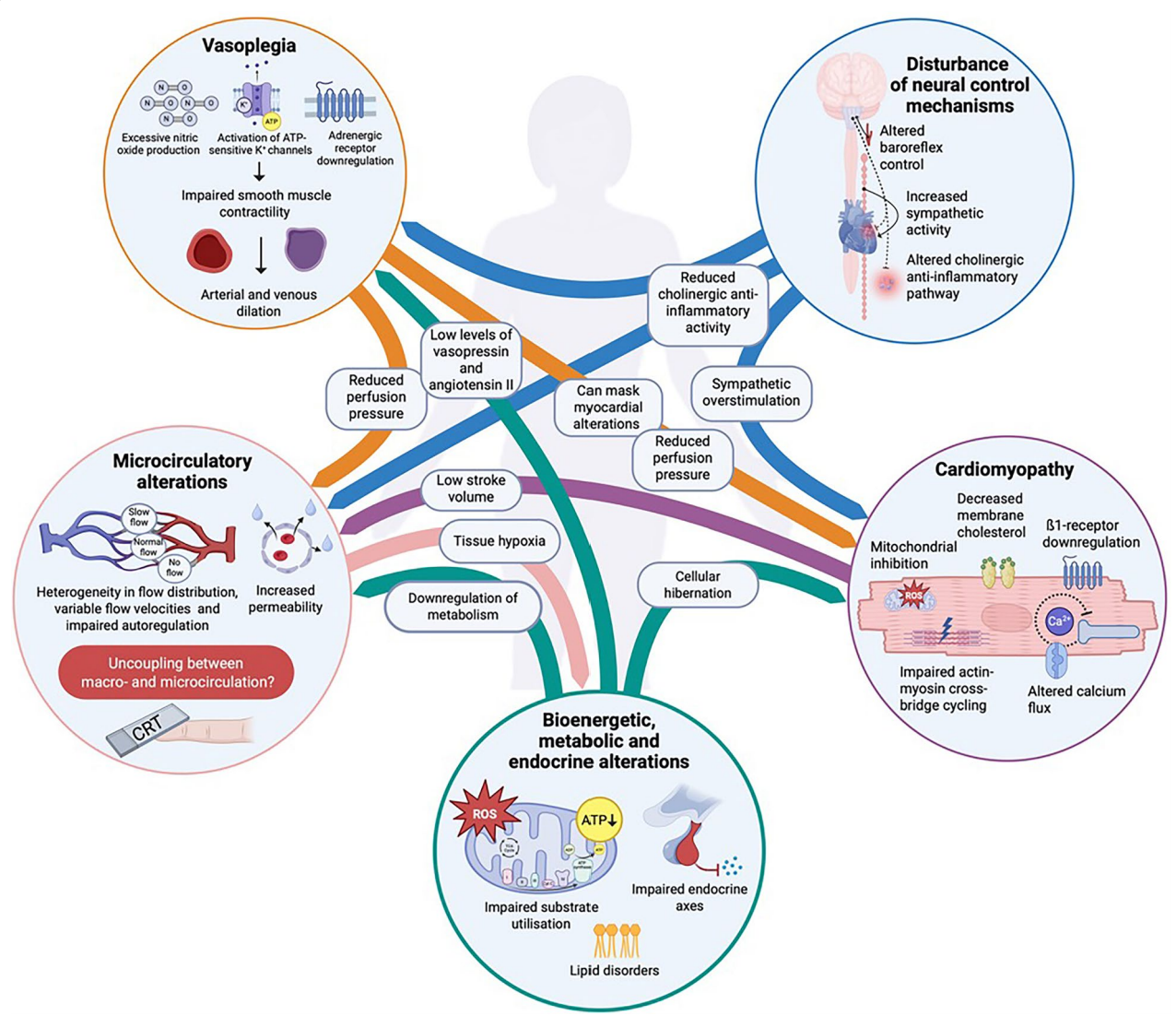 Pathophysiology of distributive shock in sepsis beyond vasoplegia