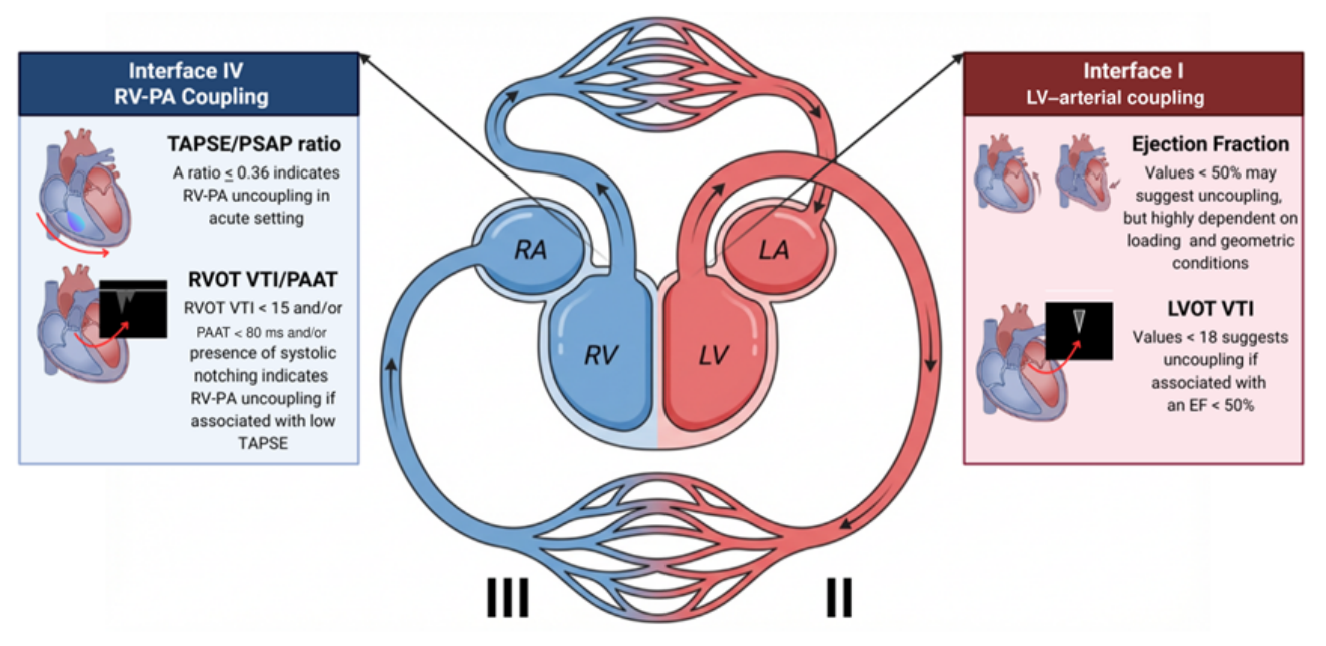 Echocardiography for Differentiating Mixed Shock : A Hemodynamic Interface Approach