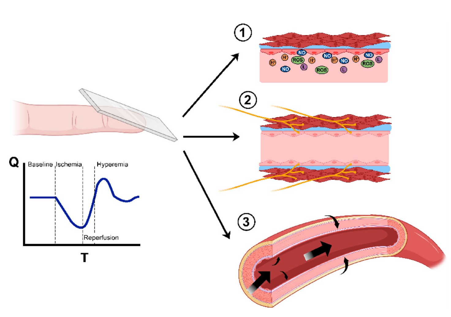 The intricate relationship between capillary refill time and systemic hemodynamics in septic shock