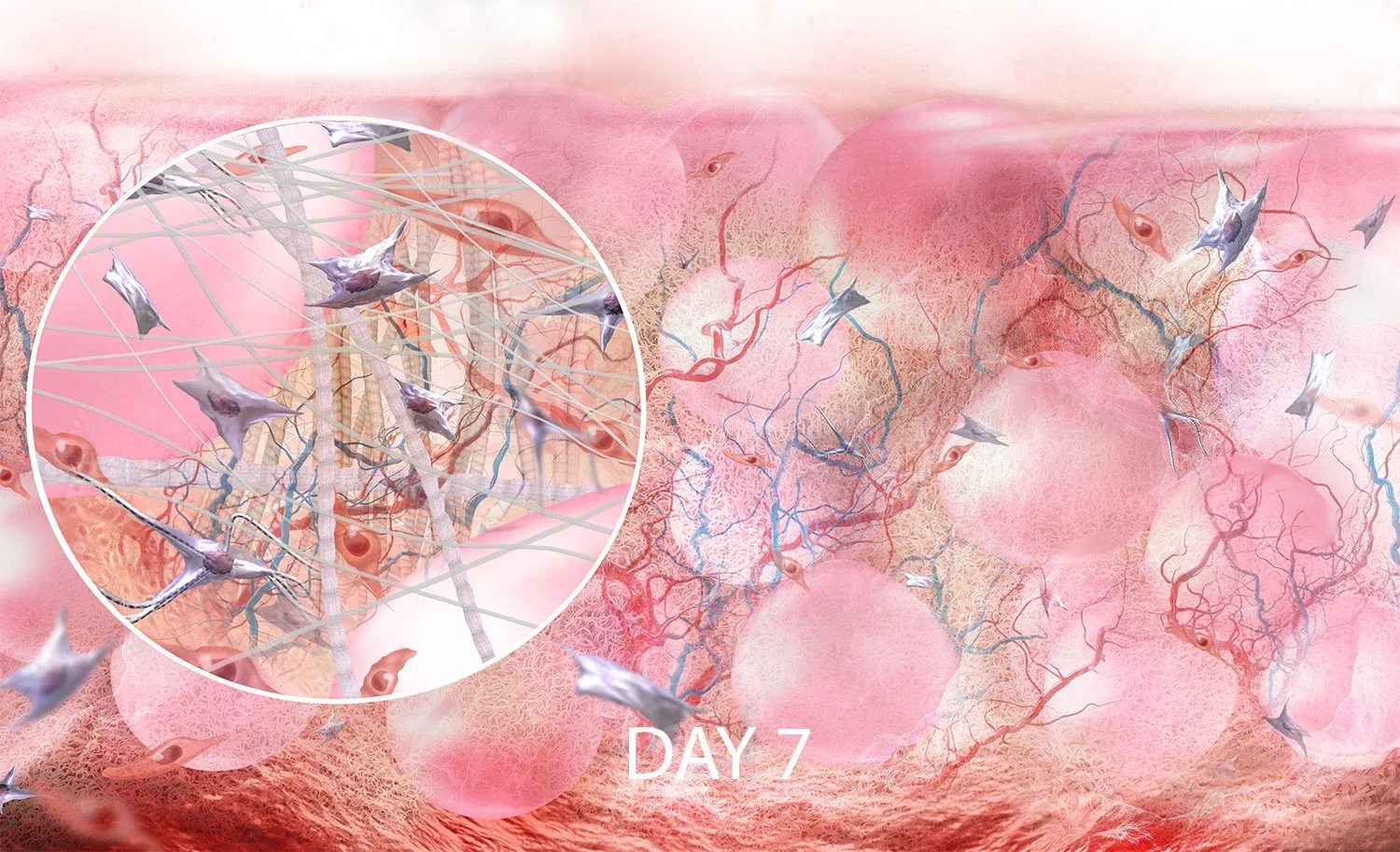 DermiSphere hDRT at day 7, showing integration and vascularisation