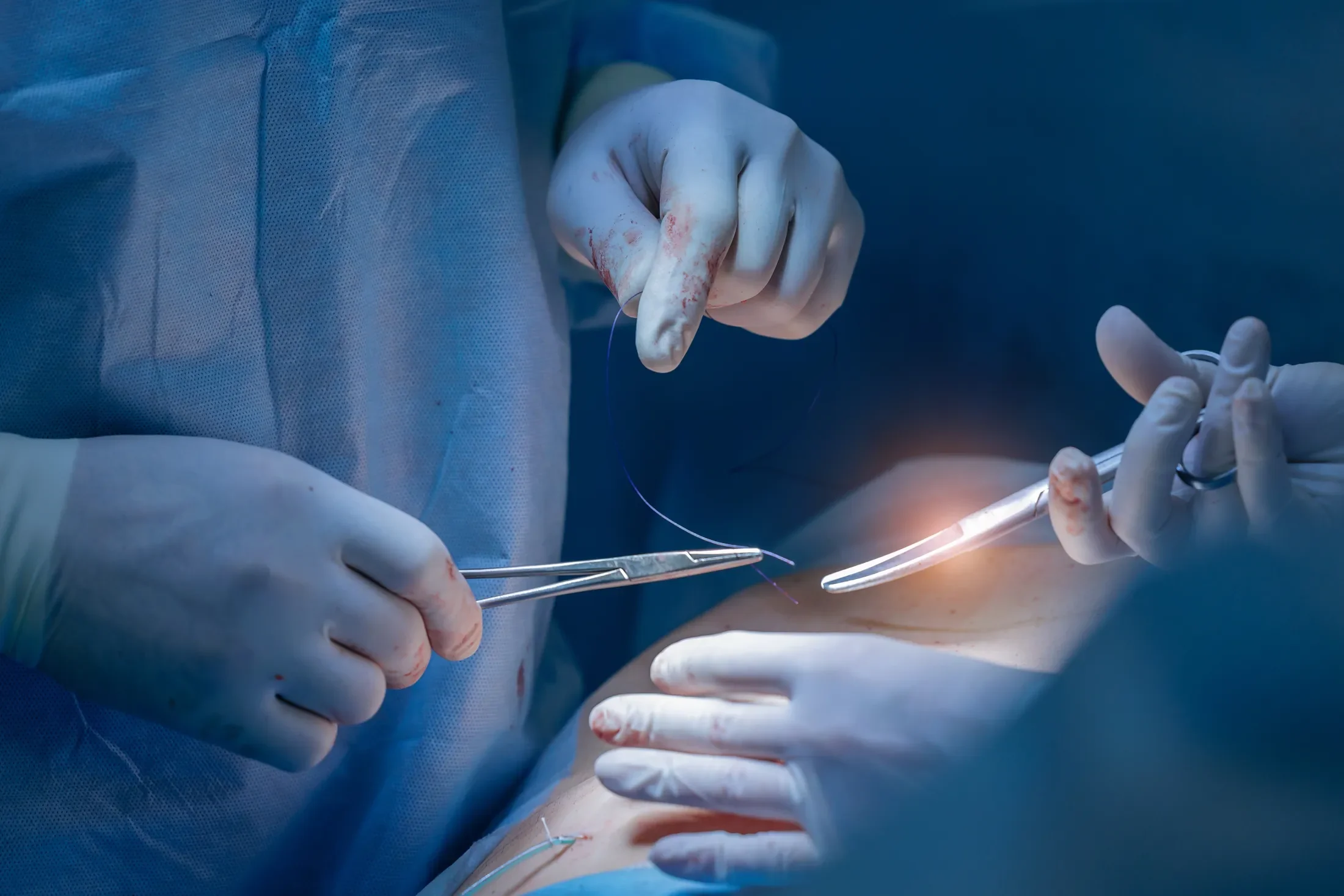 Surgeons’ gloved hands holding surgical instruments during an operation