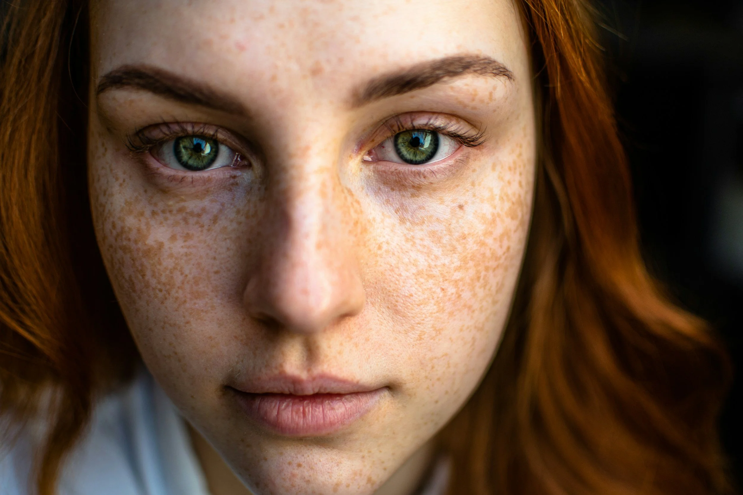 Pigmentation