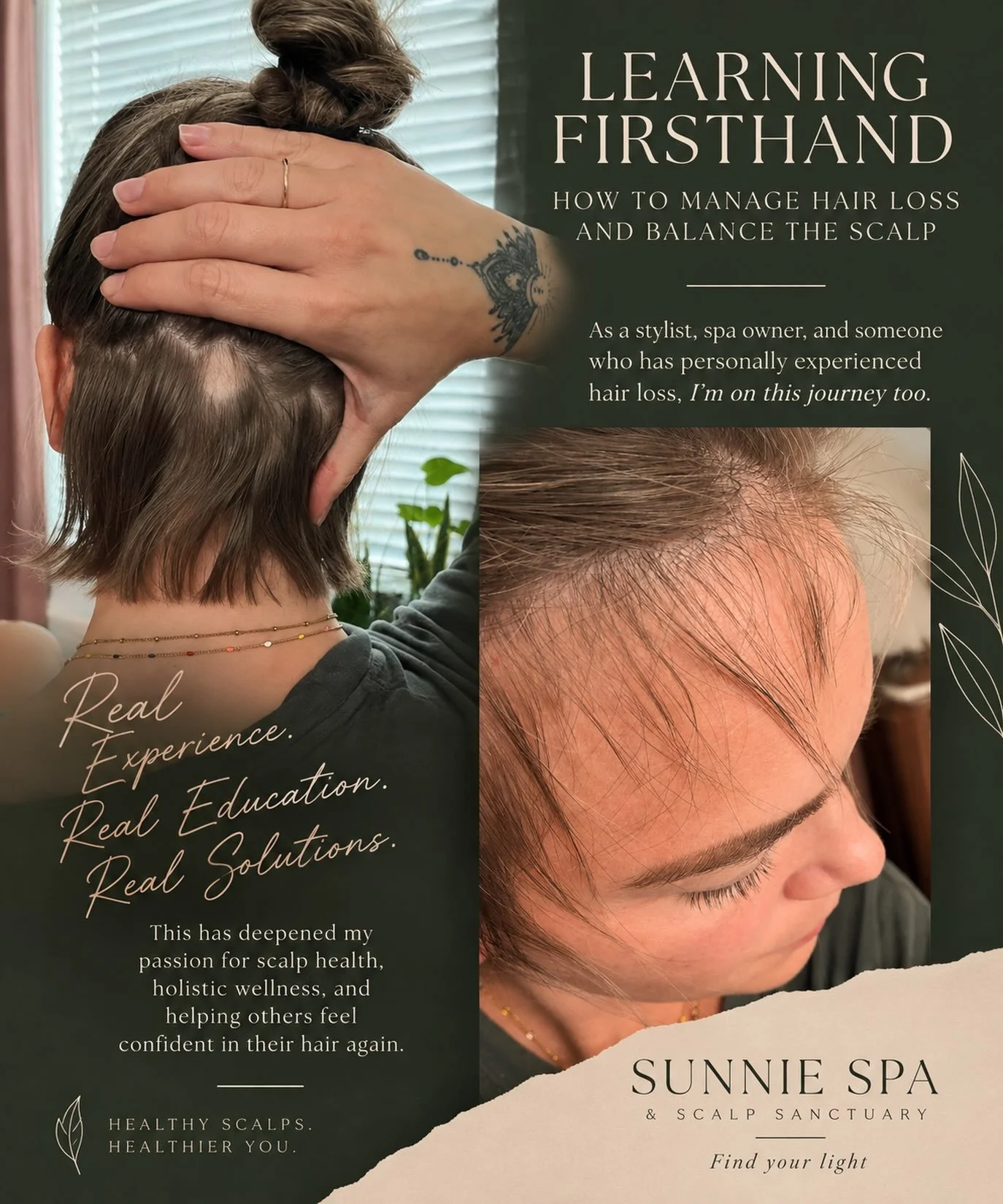 Learning firsthand. ☀️

Hair loss has a way of changing the way you see yourself, and it has given me an entirely new perspective on what it means to truly care for the scalp.

I&rsquo;m not just learning about scalp health because I&rsquo;m opening 