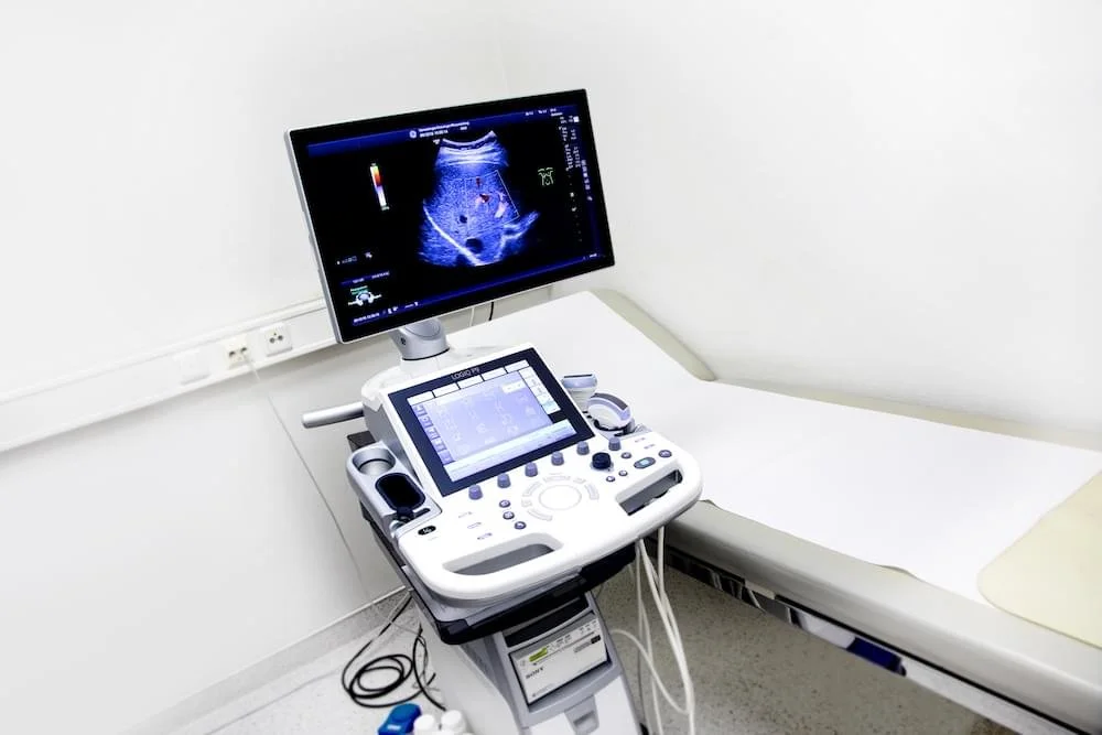Un Ultraschallgerät im Krankenhaus mit einem Monitor, der eine Ultraschallaufnahme zeigt, und ein Untersuchungsliege neben dem Gerät.