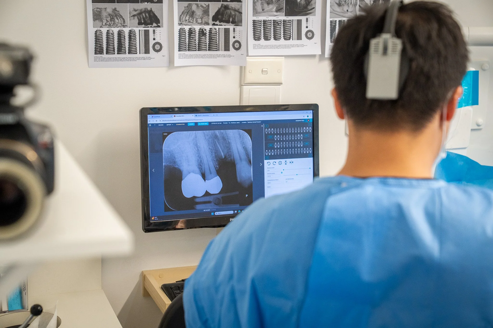root-canal-treatment-noosa