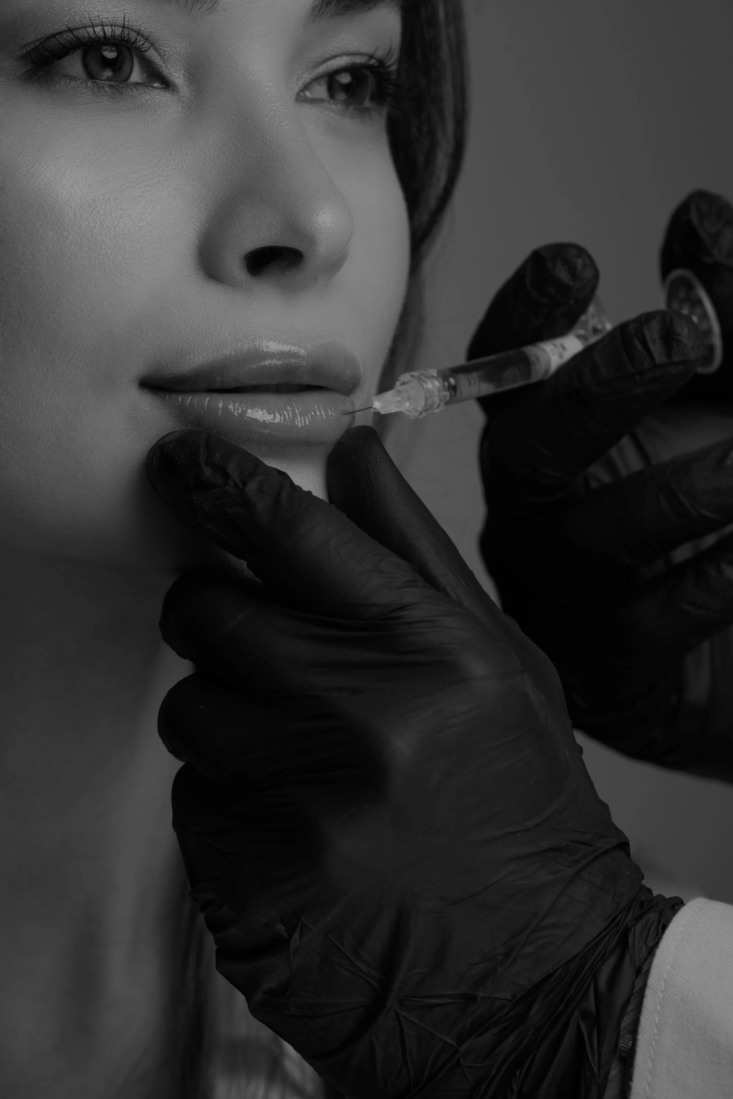 Black and white close-up of a cosmetic injector using a syringe near a woman's lips during a dermal filler treatment.