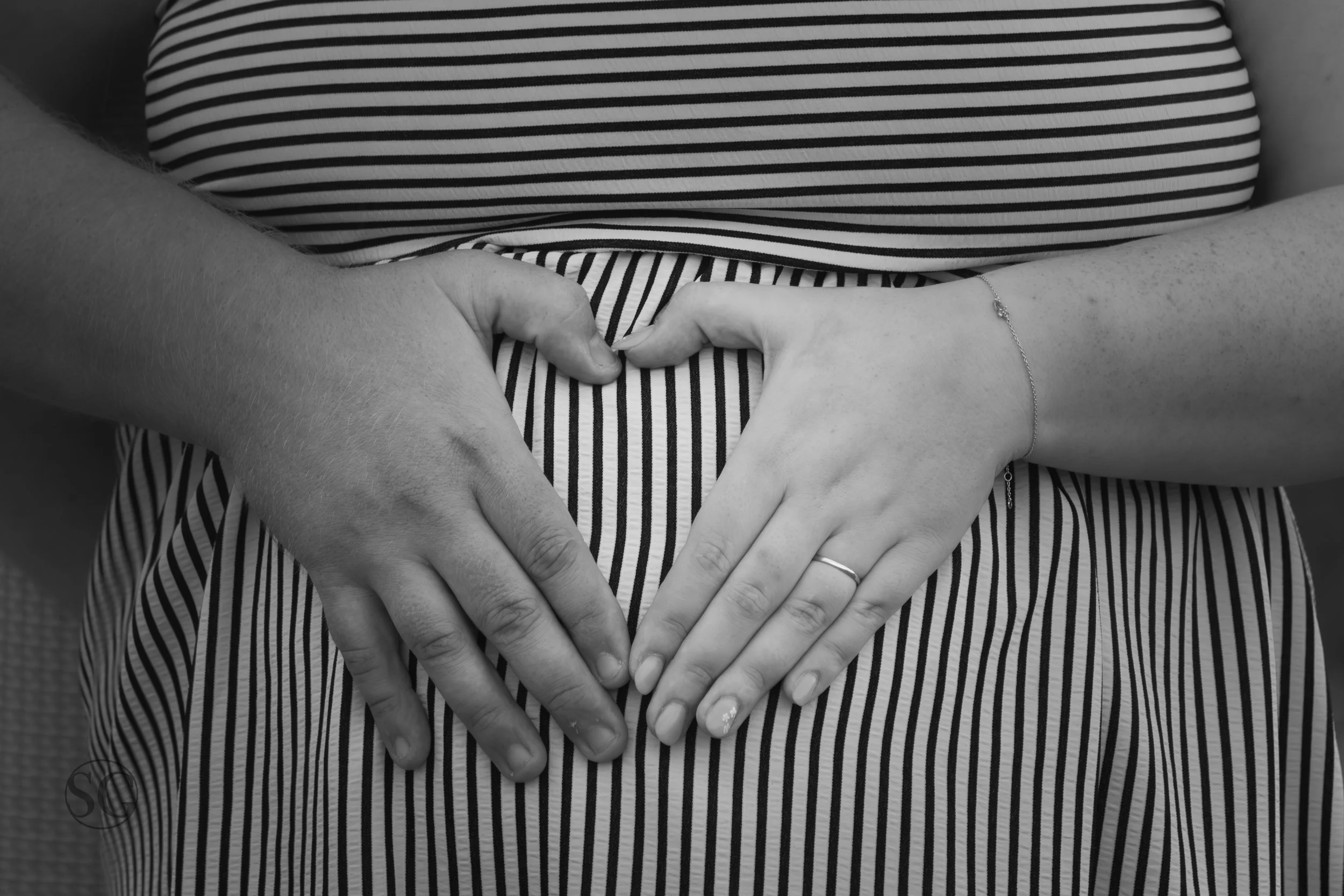 Person wearing a black and white striped dress making a heart shape with their hands, including a wedding ring and a bracelet.