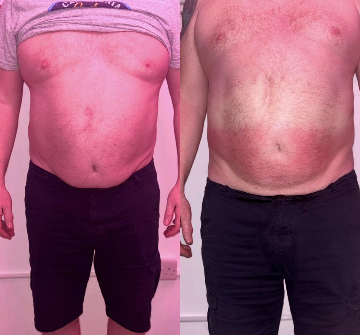 Side-by-side comparison of a man's upper body before and after weight loss, showing a significant reduction in abdominal size and increased muscle definition.