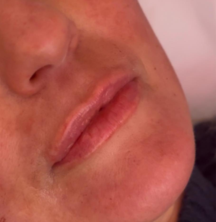 A close-up of a person's lips, nose, and lower cheek with slightly chapped lips and smooth skin.