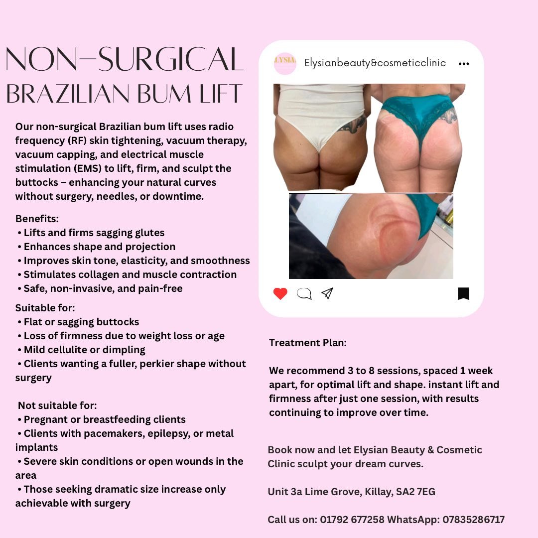 A promotional flyer for non-surgical Brazilian bum lift treatment, featuring before and after photos of a woman's buttocks, with a pink background and black text detailing the procedure benefits, suitability, and treatment plan. Contact information is provided at the bottom.