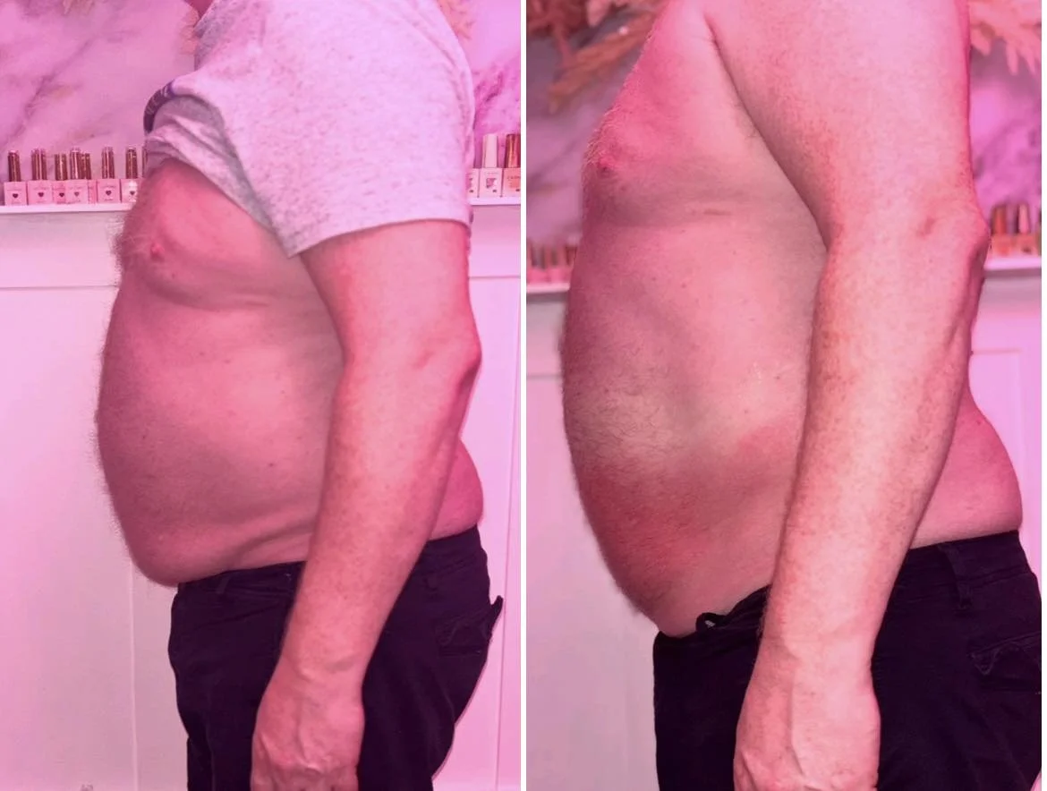 Side-by-side comparison of a man's torso before and after weight loss, showing reduced abdominal size and improved skin tone.