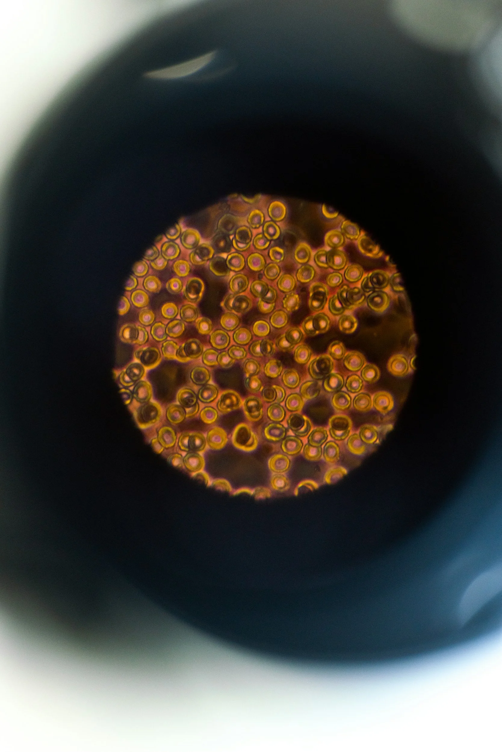 Red Blood Cells seen through the eyepiece of a microscope