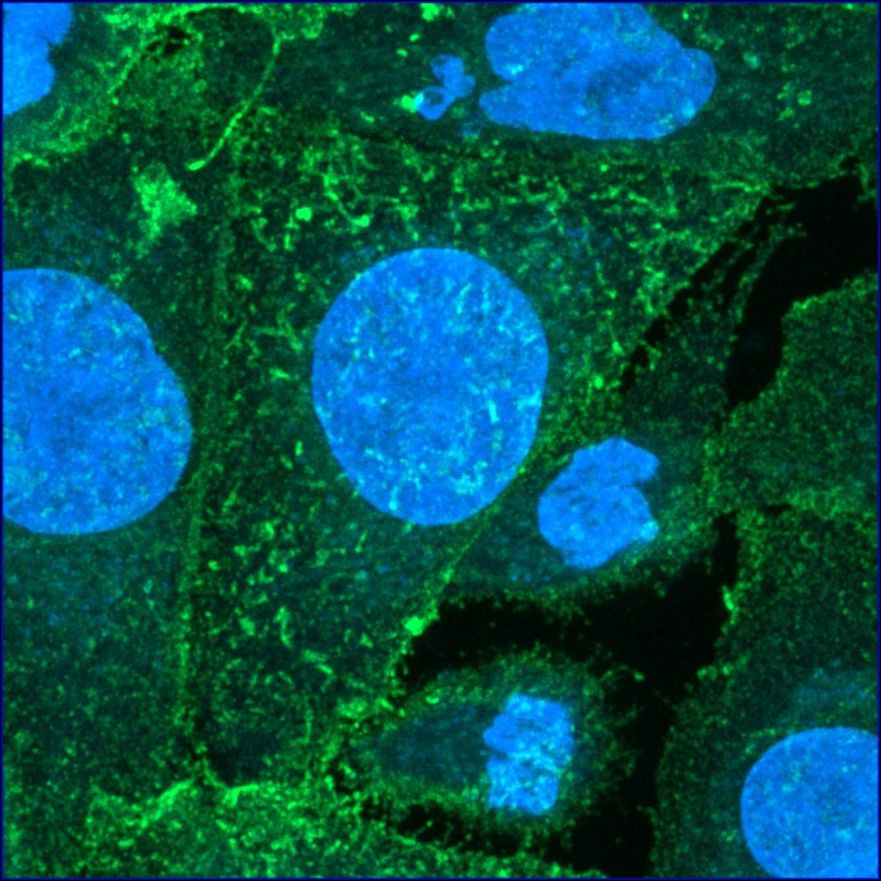 Cell line over-expressing the pain receptor TRPV1 (green).