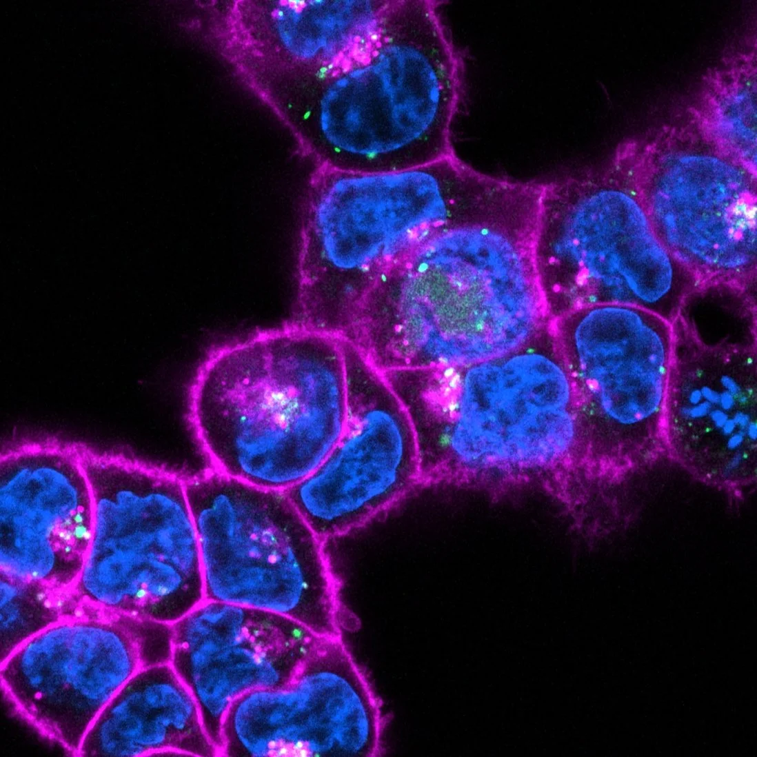 Macropinocytosis marker (green) shows distinct regions in cells responsible for the uptake of large molecules.