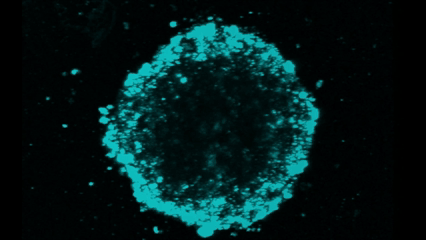 3D rendering of a tumour organoid