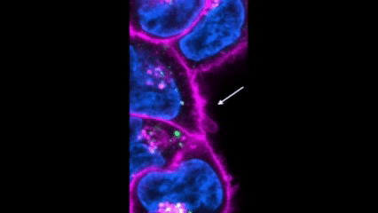 Identification of active macropinocytosis, with characteristical tent-pole formation and enveloping of the extracellular environment.