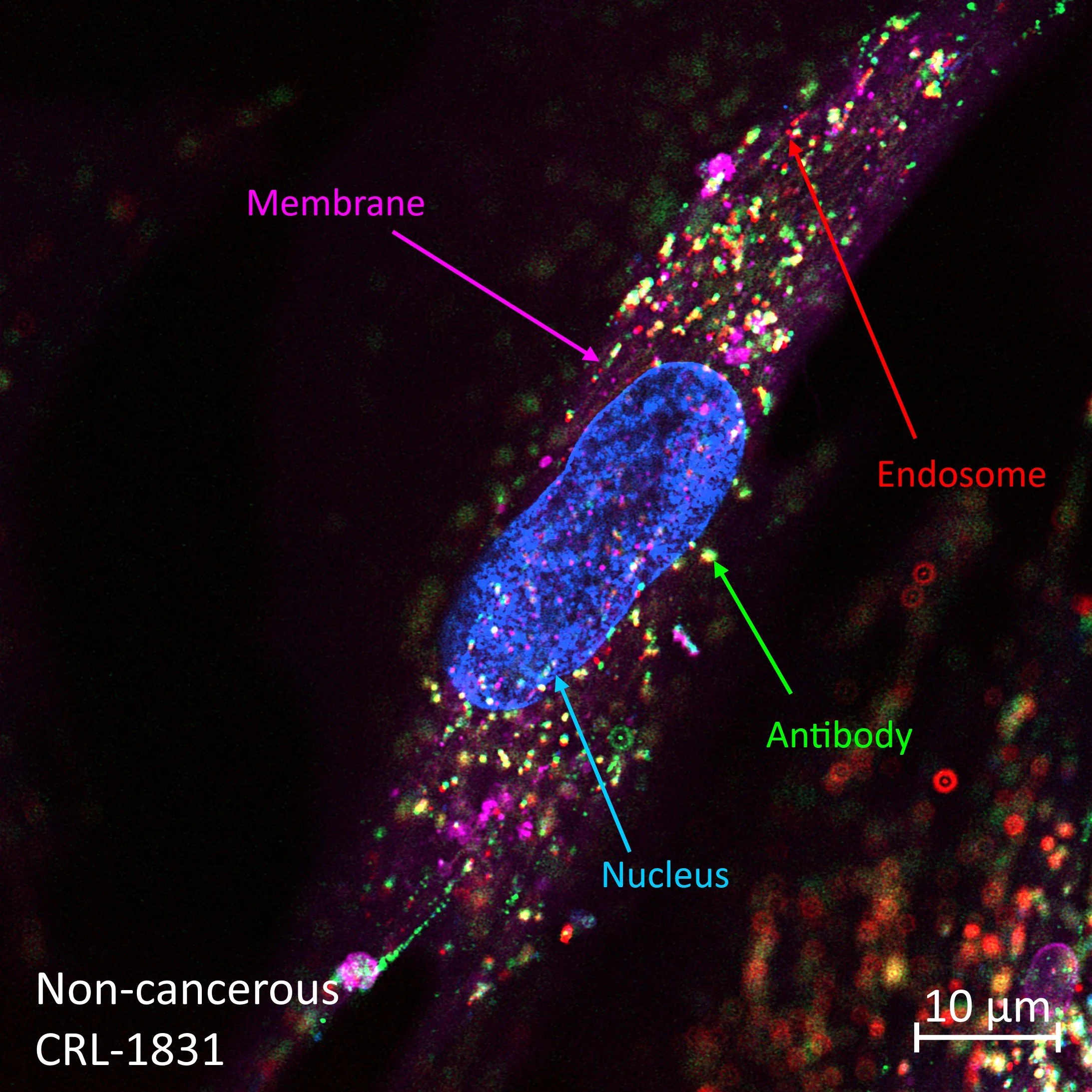 Internalization of fluorescent antibody into cancer cell, labels indicating its membrane in purple, nucleus in blue, endosome in red, and antibody in green.