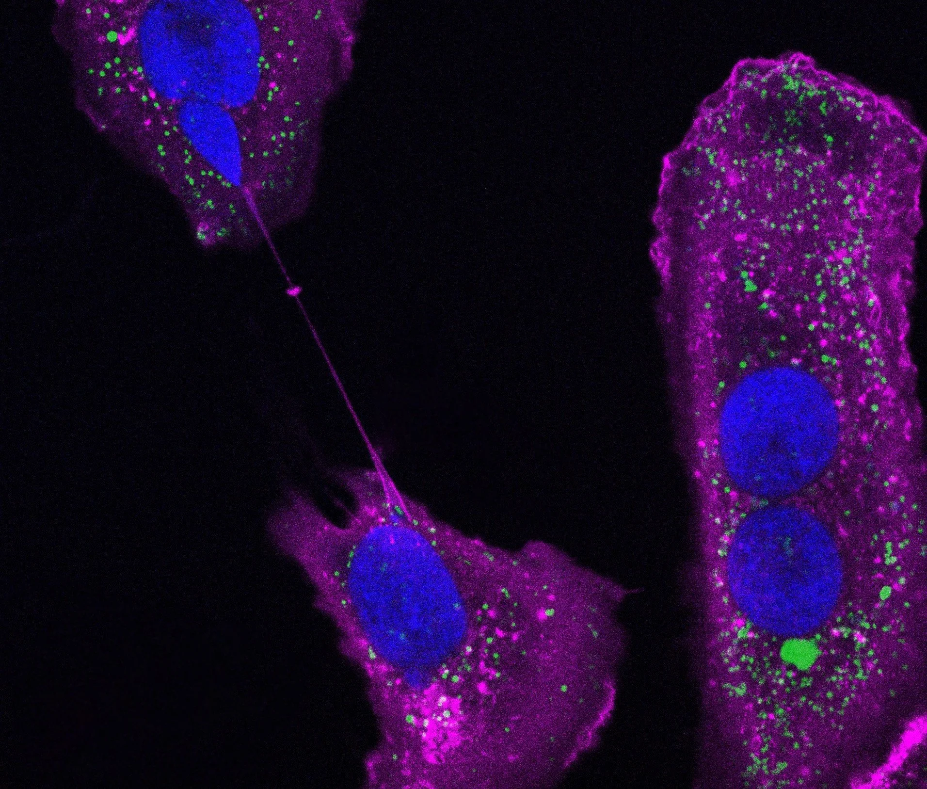 Communication between cells via membrane nanotubes.