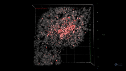 Tumour organoid, staining reveals the necrotic core.