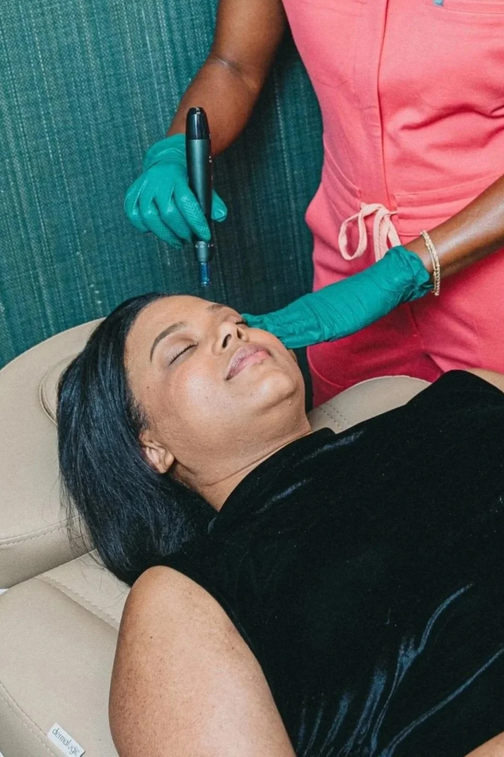 Microneedling treatment at Art of Aesthetics in Frederick, Maryland