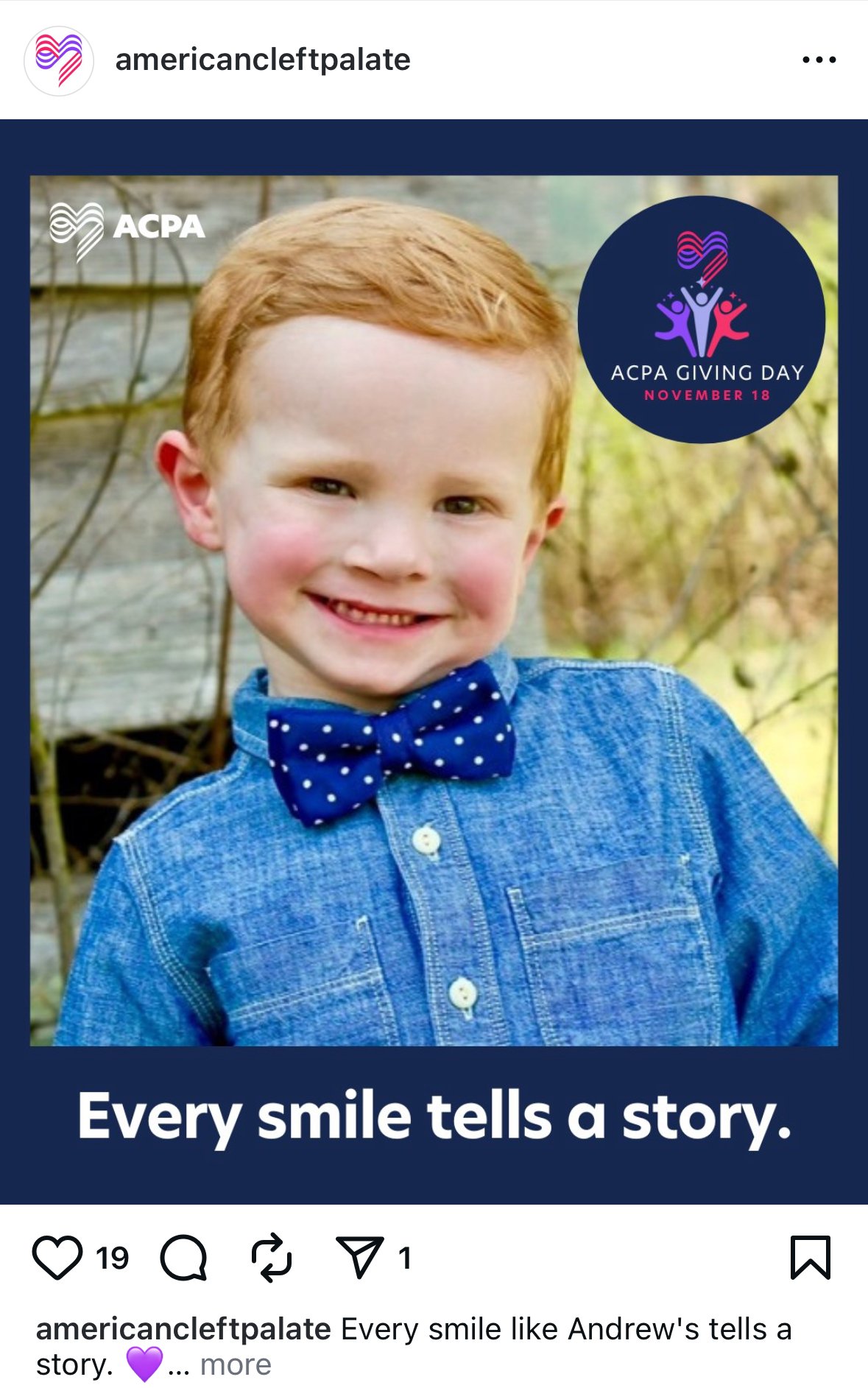 A young boy with red hair, smiling, wearing a blue denim shirt and a blue polka-dot bow tie, outdoors in front of a wooden structure and greenery.