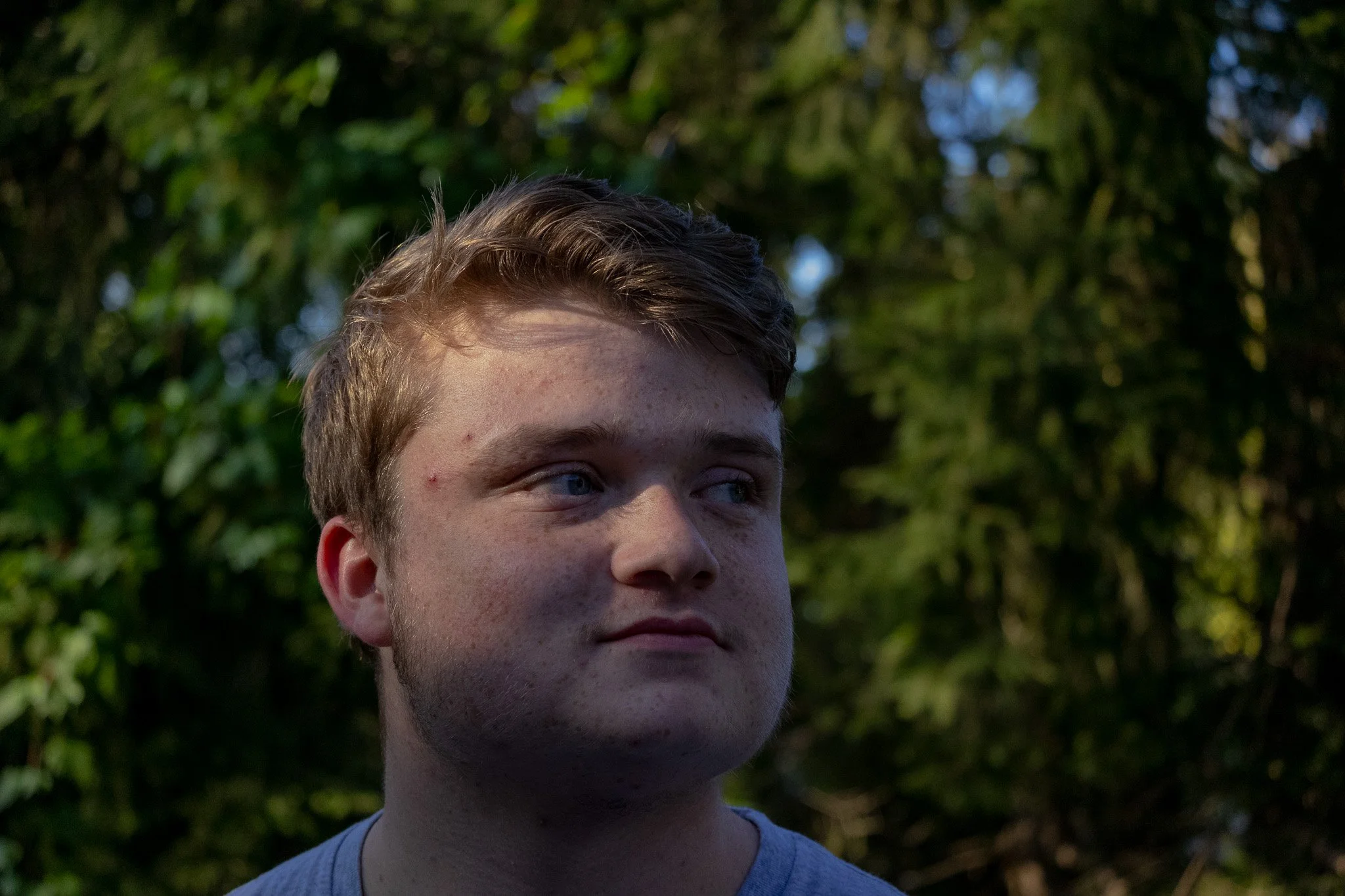 A young man with light skin, red hair, and blue eyes looking to the side outdoors, with a background of blurred green trees.