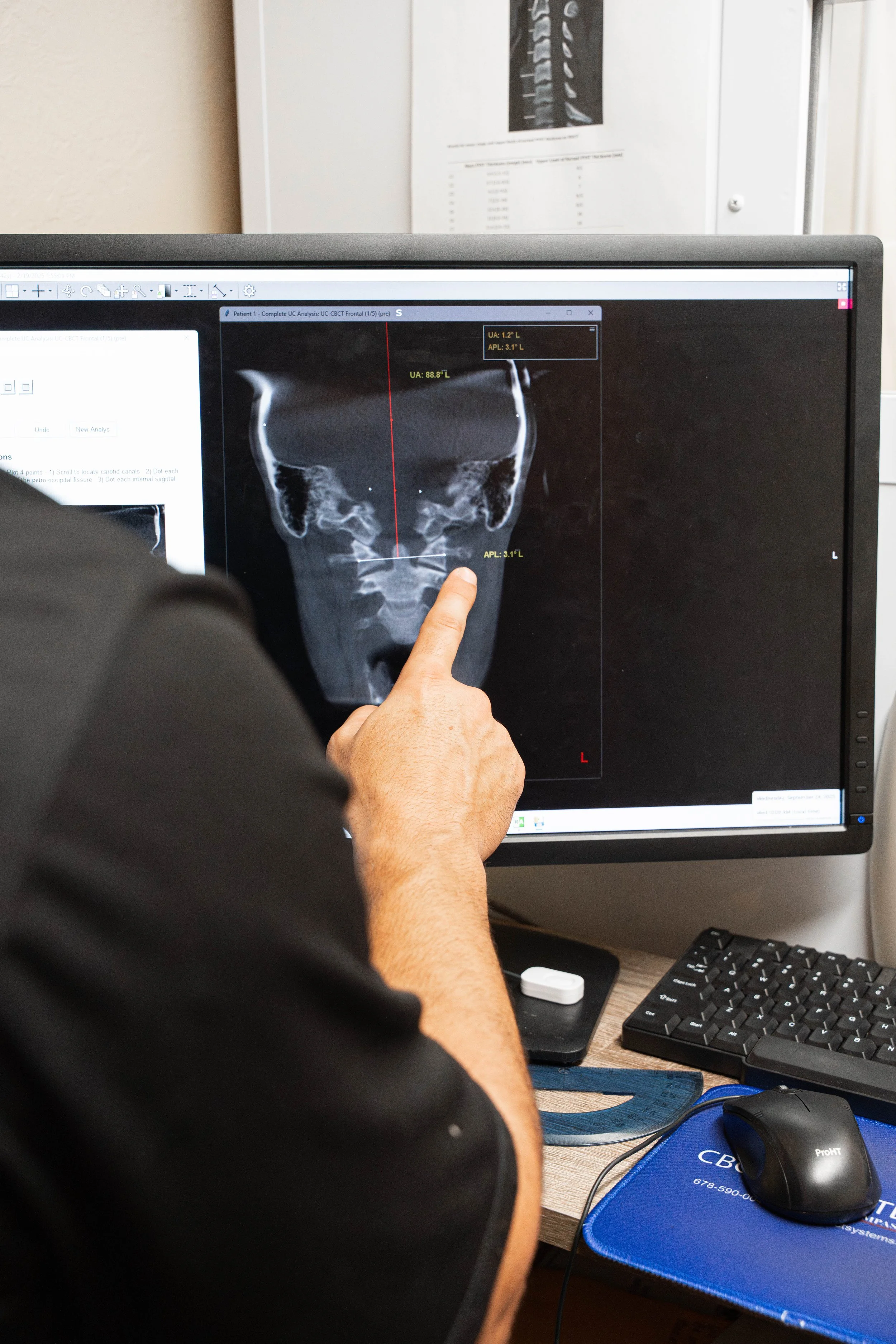 Dr. Kevin Perrino reviewing a Cone Beam CT scan to analyze atlas alignment at the Head and Neck Center of Hawai‘i.