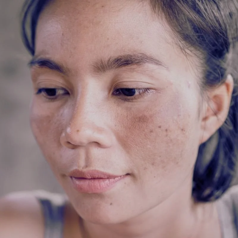 Close-up of a young woman with clear skin and freckles, looking slightly downward.