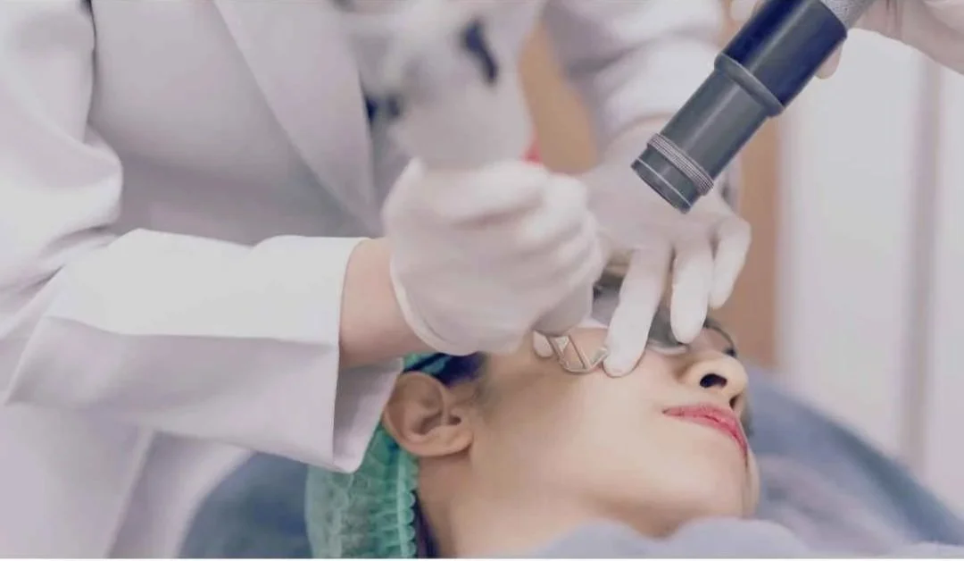 Laser in New Westminster for pigmentation and melasma