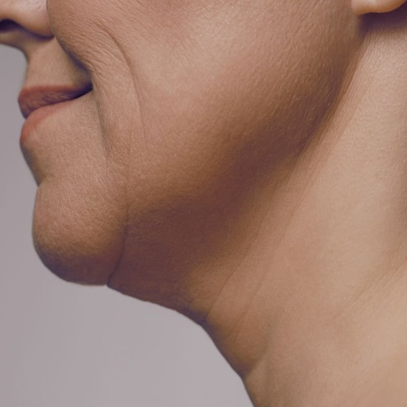 Close-up of a person's chin and lower face, showing skin texture and a slight smile.