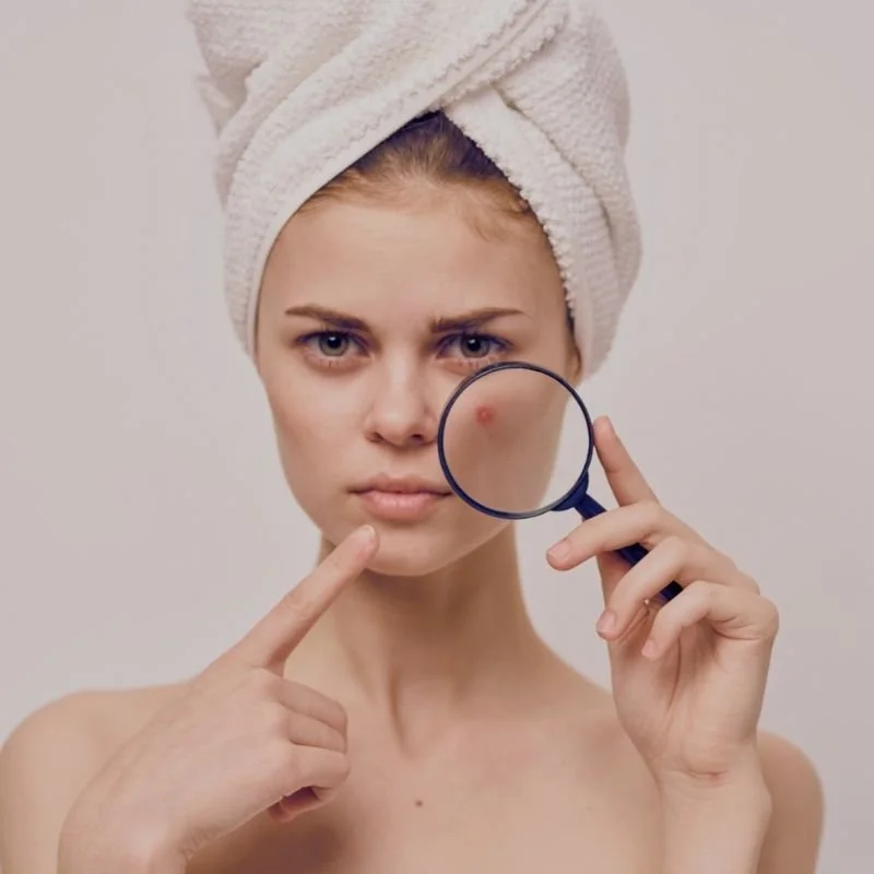 Young woman with a towel wrapped around her head, holding a magnifying glass over her face and pointing to a pimple.