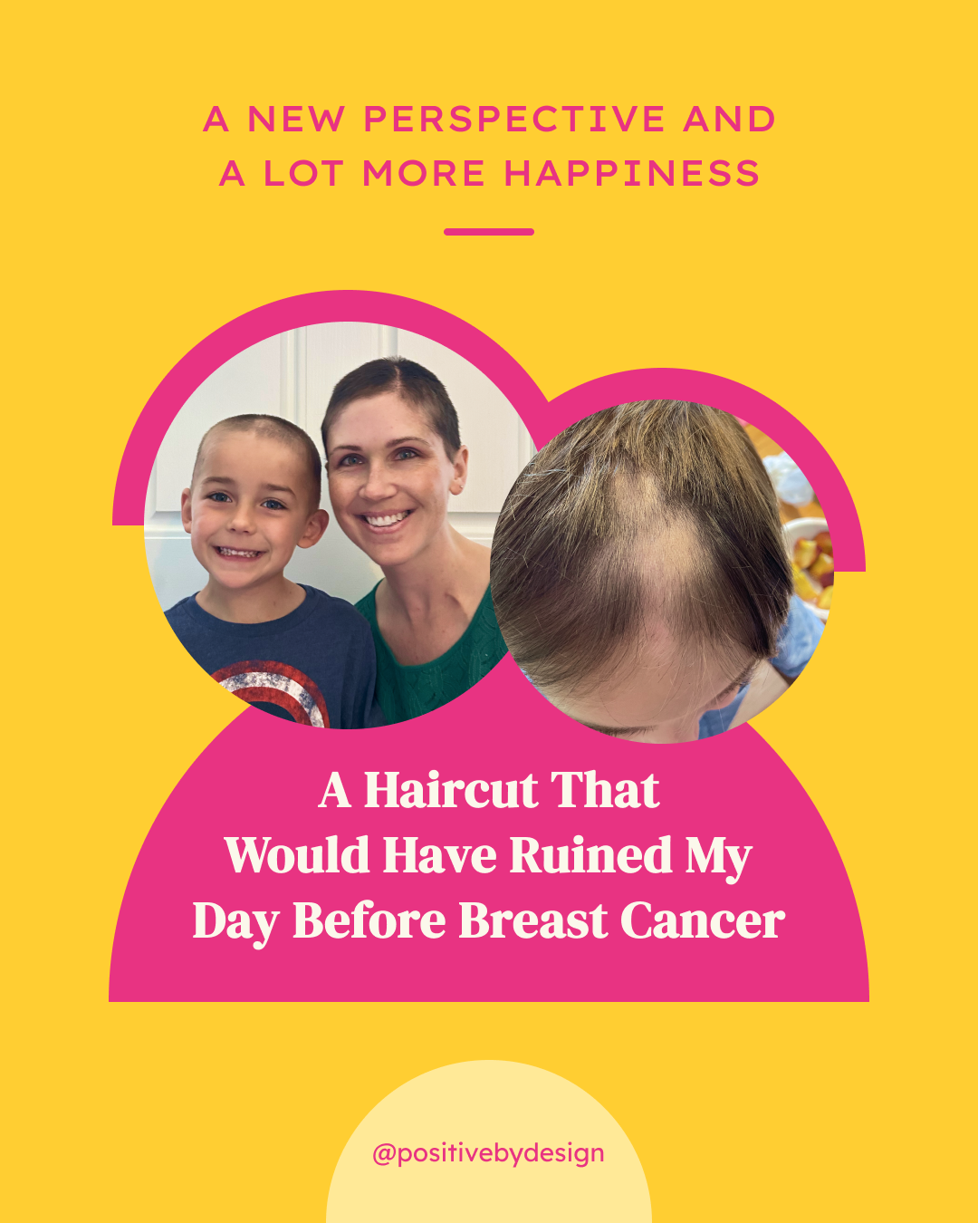 A Haircut That Would Have Ruined My Day Before Breast Cancer - 2 people with buzzed hair