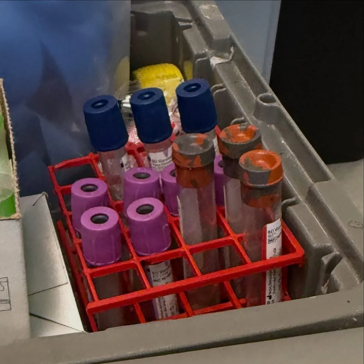 12 vials of blood every 3 months isn&rsquo;t dramatic. It&rsquo;s just Saturday when you have a chronic illness. 🩸
What healthy people get checked once a year (or never), we monitor constantly &mdash; because our bodies don&rsquo;t give us the luxur