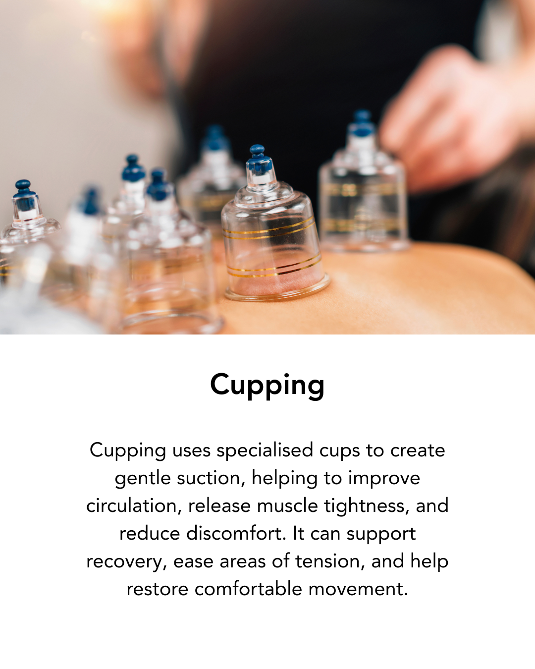 Close-up of multiple glass cupping cups placed on a person's back during a cupping therapy session.