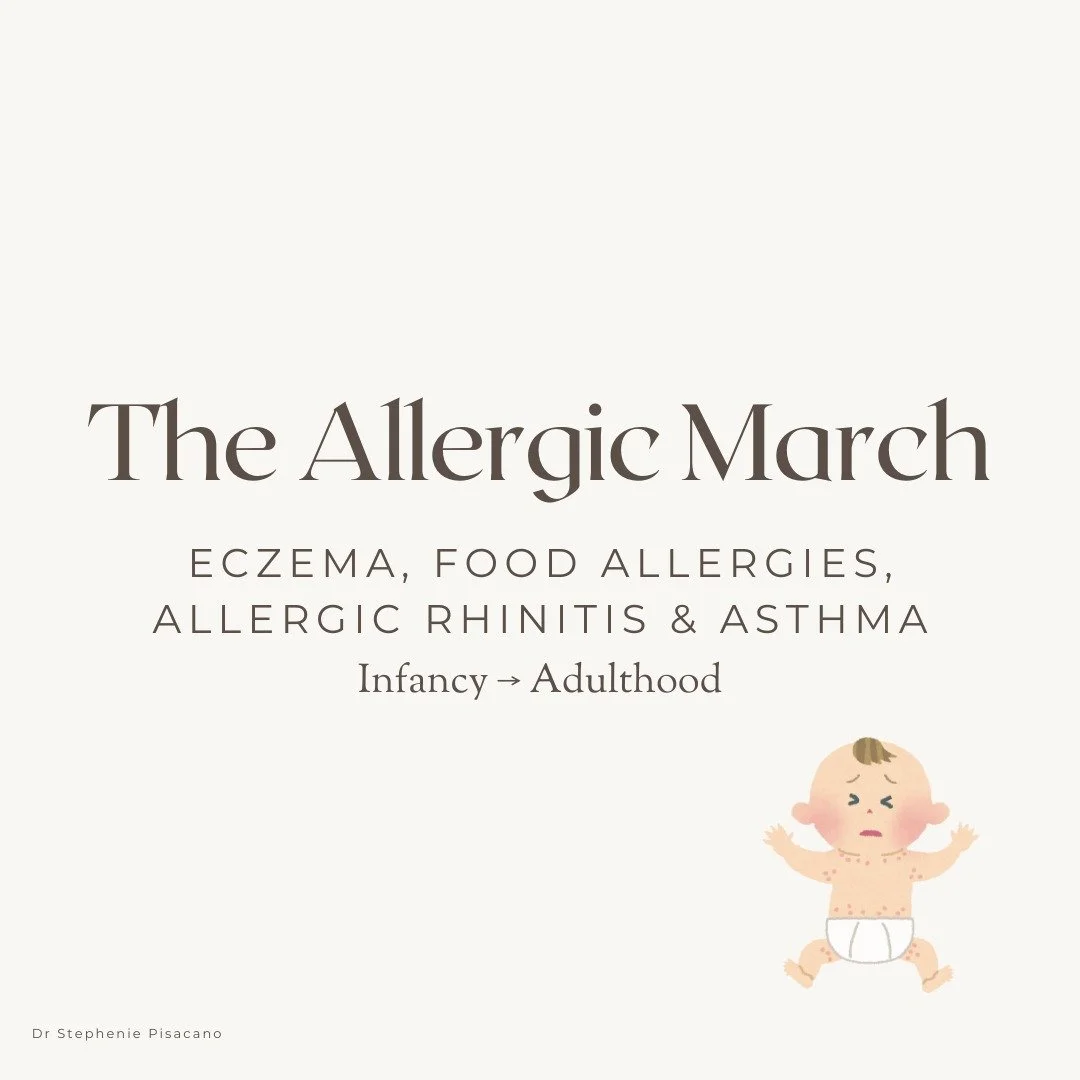 The atopic (allergic) march is when early eczema leads to a progression of allergies&mdash;like food reactions, hay fever, and asthma&mdash;as a child grows, often continuing into adulthood as chronic allergic or inflammatory disease.

The atopic mar