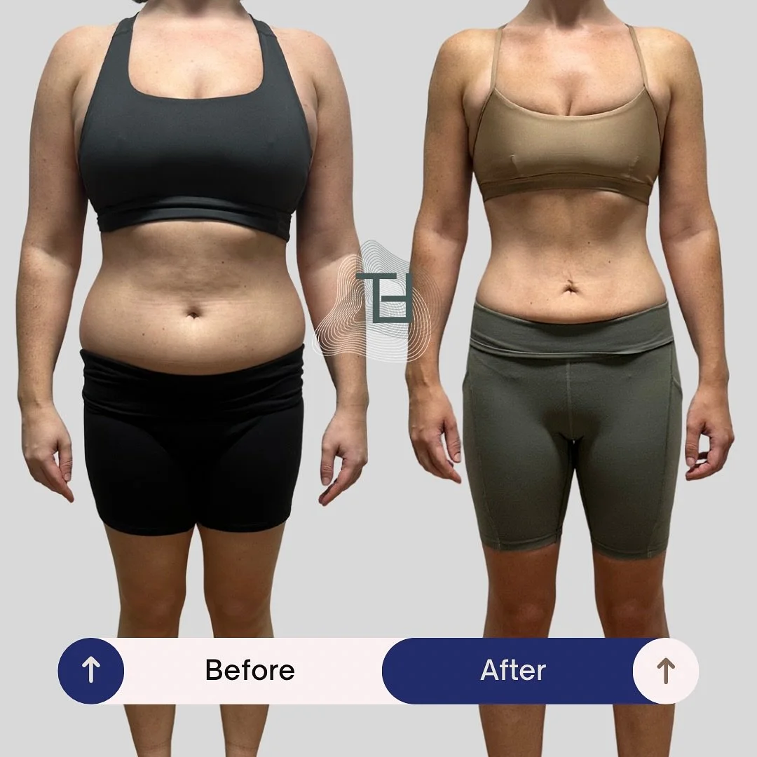 5 months of dedication of hard work result for my client this year.
🌸 13 Kg Down 
✅ 14 % body fat Down 
✅ 3 Pull Up and Tricep Dips Body Weight
✅ Squat and Deadlift more than her Bpdy Weight
✅ 20 Push Up 

Thanks for trusting in me and keep show up.