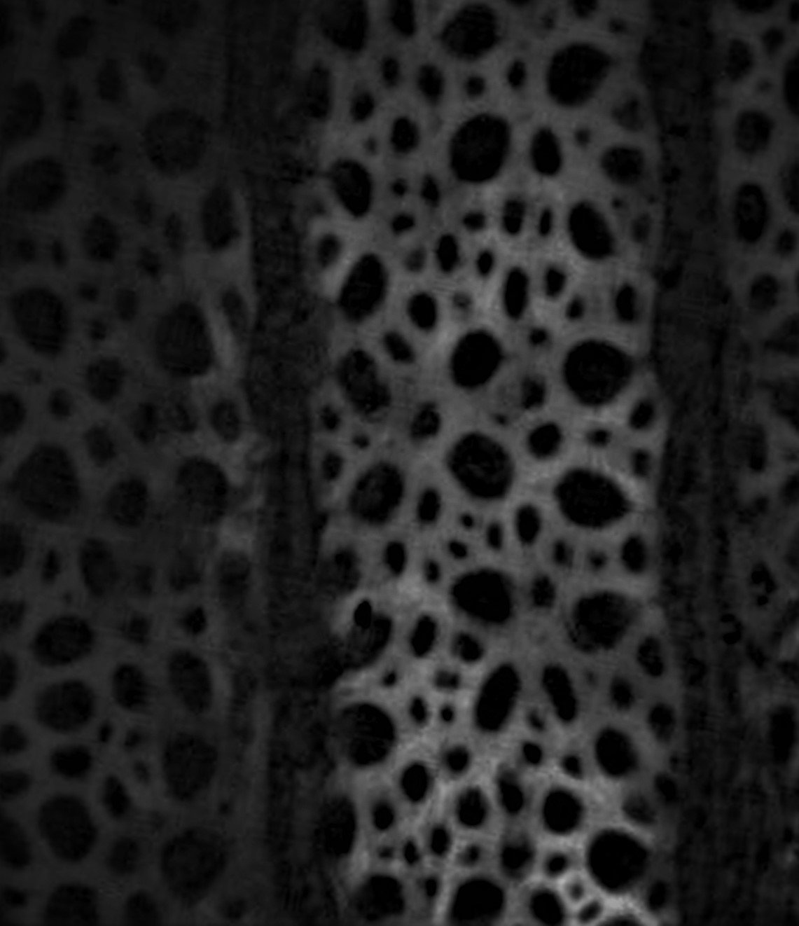 1960s Brazilian Rosewood - Silvi Scan X ray sample