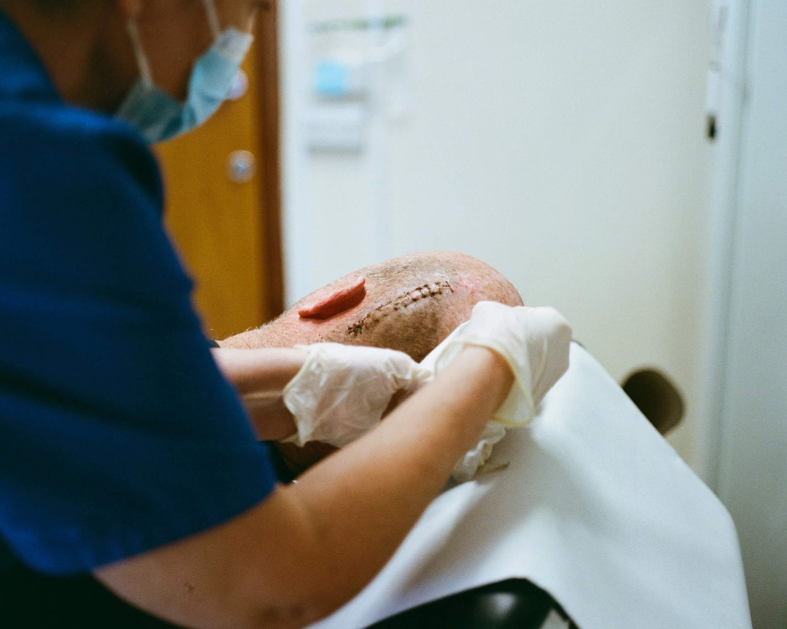Healthcare professional wearing gloves and a face mask tending to a patient who has a large surgical scar on the head.