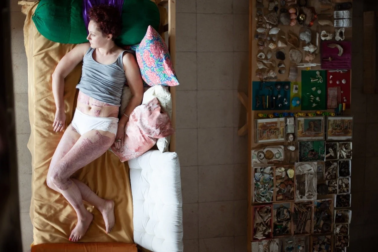 recovery - 4 of 15.jpeg