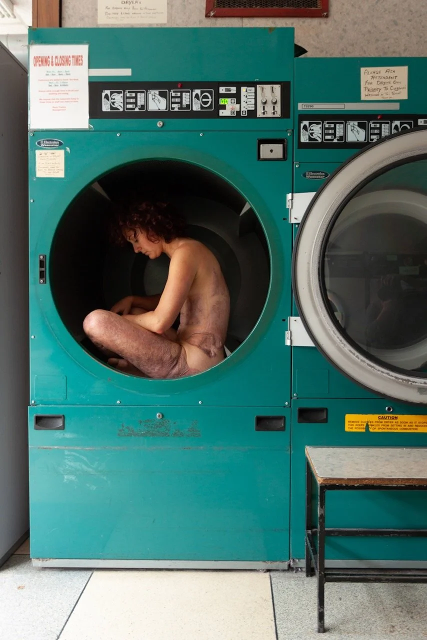 recovery - 13 of 15.jpeg